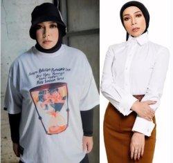 Penampilan Melly Goeslaw sebelum dan sesudah operasi bariatrik