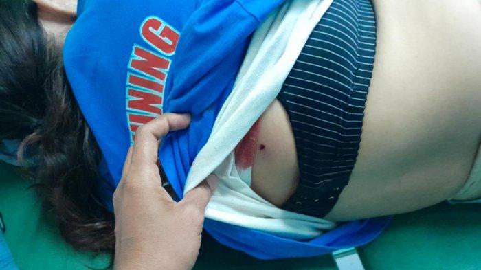 Luka tembak - Rekan ES saat mengecek luka tembak pada punggung wanita 43 tahun itu. ES diduga tertembak peluru nyasar saat sedang bekerja pada Jumat (11/4/2025).