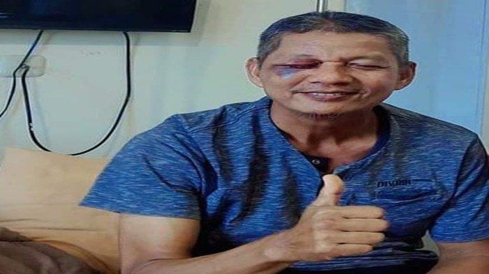 Foto kondisi Zaharman, guru SMA 7 Rejang Lebong, Bengkulu yang diketapel orang tua siswa. Ia kini dirawat di Rumah Sakir Ar Bunda, Lubuklinggau, Sumatera Selatan.