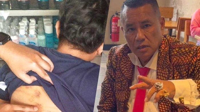Pengacara kondang di tanah air Hotman Paris mulai kebanjiran DM korban lain penyiksaan dan penculikan oleh oknum Paspampres Praka Riswandi Manik dan dua oknum TNI lainnya.