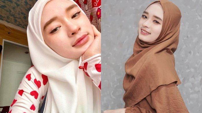 Paras cantik Inara Rusli, istri Virgoun belakangan ini tengah menjadi perhatian publik. Istri Virgoun sampai disebut operasi plastik.