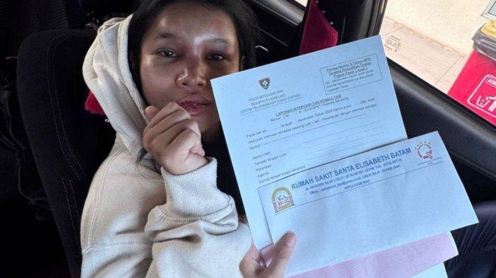 Tangkapan layar Yolanda, wanita muda di Batam, korban penganiayaan mantan pacarnya, saat memperlihatkan surat keterangan hasil visum dari RS Elisabeth
