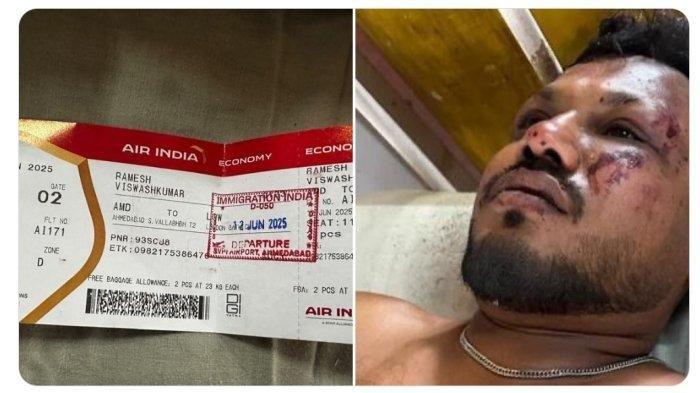 SATU PENUMPANG SELAMAT- Kecelakaan pesawat Air India di Ahmedabad secara ajaib menyisakan satu orang yang selamat. Korban selamat, yang sedang menjalani perawatan, telah diidentifikasi dia bernama Vishwas Kumar Ramesh, warga negara Inggris yang kembali ke London setelah kunjungan ke Gujarat.