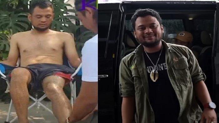 Berikut ini kondisi Panji Petualang viral di media sosial. Bahkan kondisi tubuhnya saat ini begitu memprihatinkan karena kurus kering. Tak seperti tubuh yang dulu, Panji Petualang kehilang sejumlah berat tubuhnya. Sebelum mengalami perubahan kondisi tubuhnya, Panji Petualang sempat digigit king kobra.