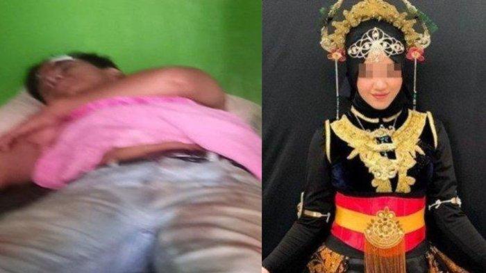 Kolase Kondisi Aldo Pasca Dibegal (Kiri) dan Foto Nazwa Semasa Hidup (Kanan).