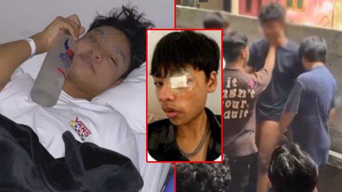 Kebohongan korban bully geng anak vincent, drama ngaku matanya ditusuk, ternyata minus