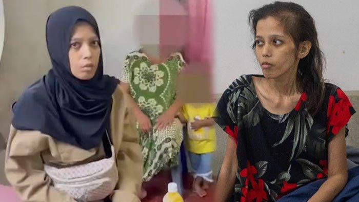 Pelakuan ibu ke mantan TKI di Bogor usai operasi miom rupanya cukup memprihatinkan. Bahkan saat Dona dijemput dari rumah ibunya di Bogor, terlihat beberapa orang di sana tak menghiraukan penjemput yang datang.