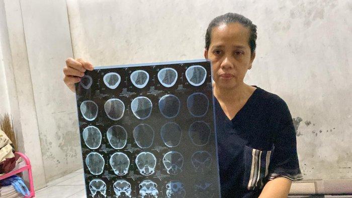 Siti Maslihat (46), ibu korban pelajar di Megamendung, Kabupaten Bogor yang tewas diduga akibat perundungan menunjukkan hasil rontgen bagian kepala anaknya, Sabtu (7/9/2024)
