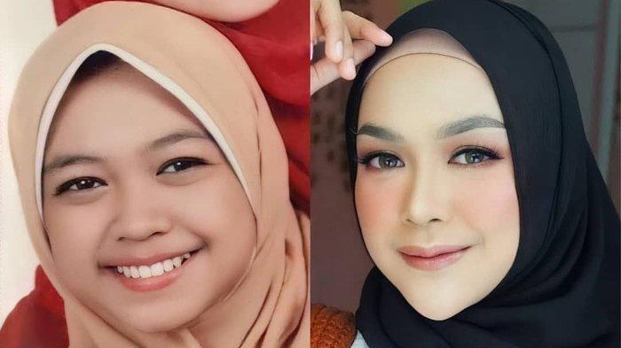 Transformasi wajah Ria Ricis dulu (kiri) dan sekarang (kanan)