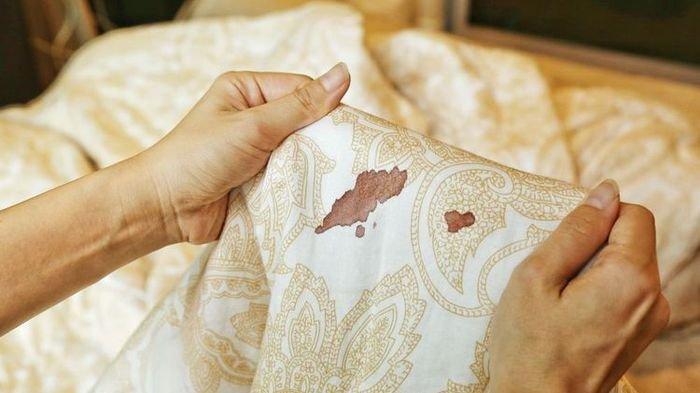Intip tips seputar rumah yakni cara menghilangkan noda darah mengering di seprai dan bed cover yang sudah lama.