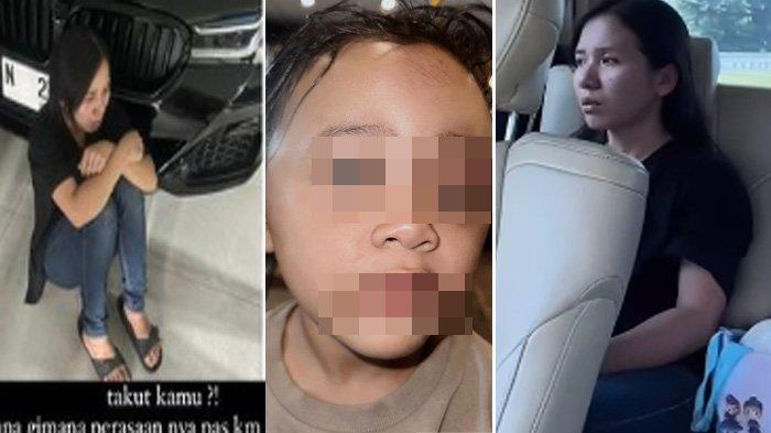 Sosok dan identitas suster yang siksa anak selebgram Aghnia hingga bonyok terungkap. Pelaku atur siasat satu jam lebih aniaya korban.