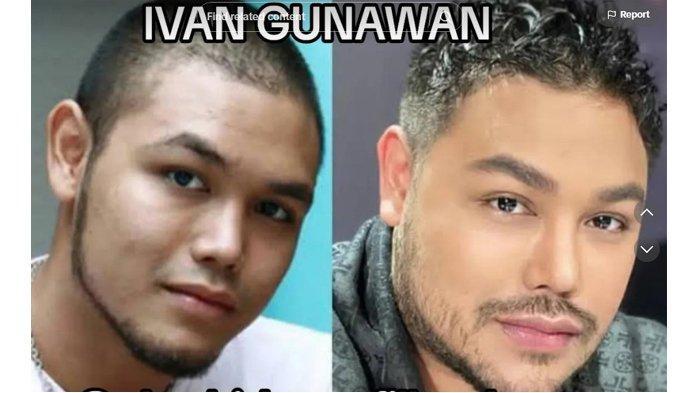 Transformasi wajah Ivan Gunawan dulu (kiri) dan sekarang (kanan)