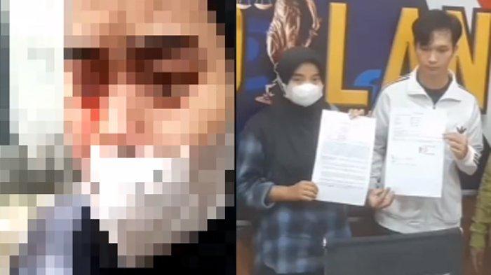 Tampang pemuda Bogor yang viral gara-gara menghajar sang pacar hingga pelipis mata korban robek dan berdarah-darah. Pelaku dan korban memilih untuk berdamai