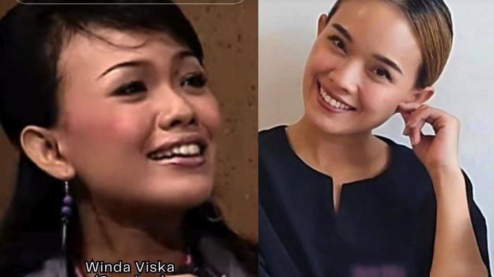 Transformasi artis lawas pemeran sitkom OB office boy yang pernah tenar di tahun 2006. Salah satunya adalah Winda Visca sebagai Saschya