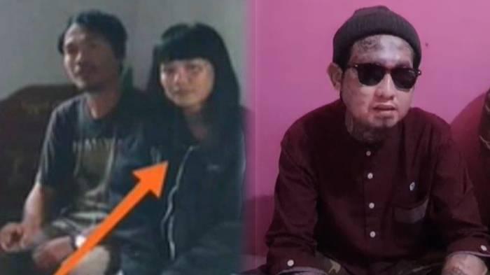 Korban congkel mata di Bogor, Faisal, menceritakan kronologi kejadian sebenarnya.