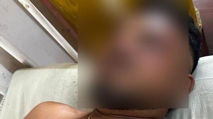 SELAMAT DARI KECELAKAAN - Ramesh Vishwaskumar adalah satu-satunya penumpang pesawat Air India yang selamat, setelah pesawat itu jatuh di Ahmedabad, India.