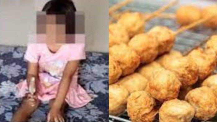Sosok siswi SD di Gresik matanya dicolok kakak kelas pakai tusuk bakso, kini mengalami kebutaan, ternyata belum bisa masuk sekolah