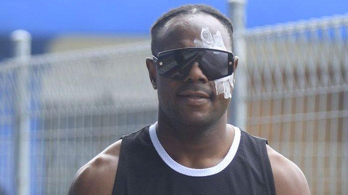 DIPERBAN - Pemain Persib Bandung Victor Igbonefo mata sebelah kirinya diperban setelah menjalani pengobatan saat menghadiri latihan di Stadion Sidolig, Bandung, Senin (27/6). Victor mengalami cedera pada pertandingan Piala Presiden beberapa waktu lalu.