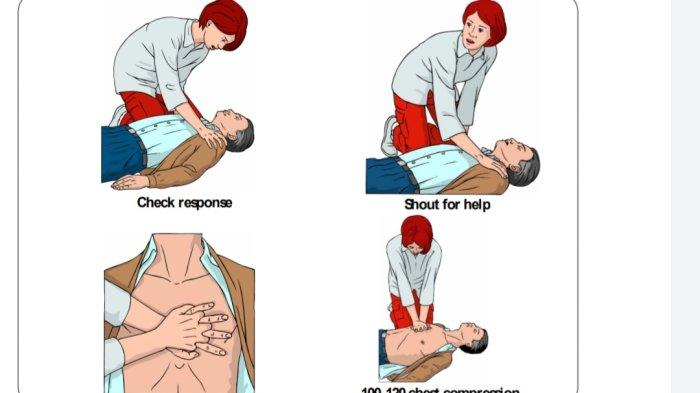 Tindakan penanganan dasar yang disebut dengan Basic Life Support (BLS) pada seseorang yang alami henti jantung.
