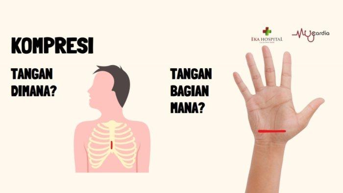 Cara melakukan kompresi dada