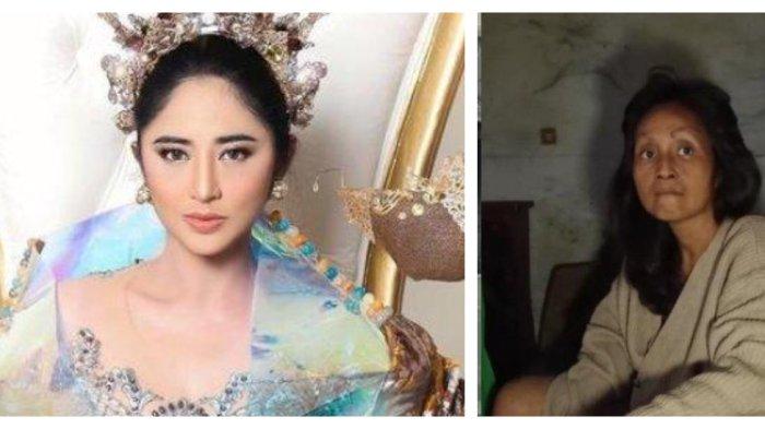Kolase foto Dewi Perssik dengan Putri, ODGJ yang mengaku model dewasa.