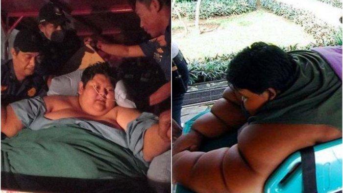 Pasien obesitas Muhammad Fajri (kiri) dan Arya Permana (kanan) yang pernah ditangani Rumah Sakit Cipto Mangunkusumo (RSCM) Jakarta.
