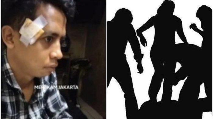 Ridho mengalami luka-luka usai dituduh maling dan dipukuli sekelompok warga di Jalan H Jian 2B, Cipete Utara, Kebayoran Baru, Jakarta Selatan, Selasa (25/7/2023).