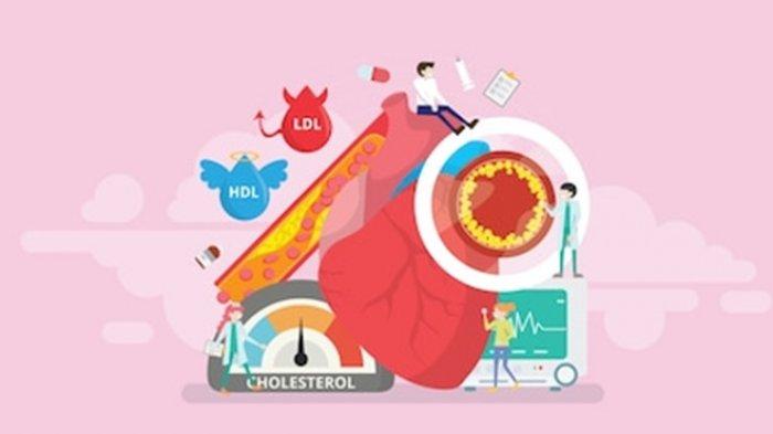Ilustrasi kolesterol