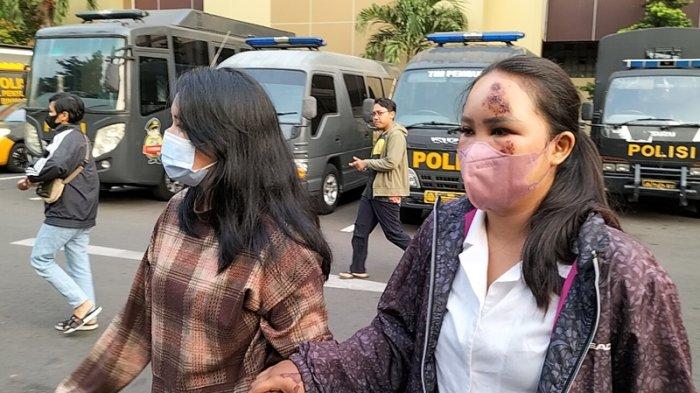 Wanita bernama Dyah Ambar Wulan (22) didampingi saudaranya mendatangi Polres Metro Jakarta Selatan di Kebayoran Baru, Jakarta Selatan, Minggu (4/6/2023), untuk membuat laporan kepolisian usai dirinya diduga ditabrak pacar sendiri di Jalan Prapanca Raya, Kebayoran Baru, Jaksel.