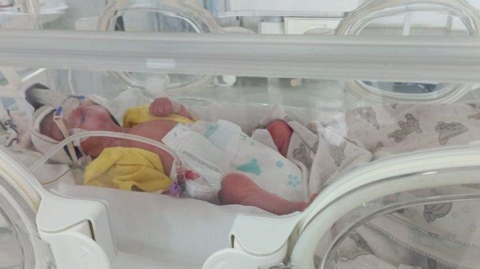 BAYI KEMBAR EMPAT - Bayi kembar empat saat berada di inkubator Rumah Sakit Mitra Medika Batanghari, Kamis (20/2/2025).