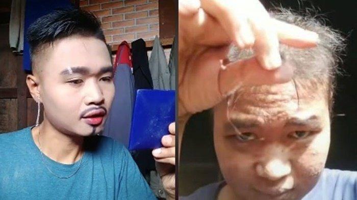Popo Barbie mengaku sempat sakit parah. Rambutnya mulai rontok dan wajahnya jadi rusak.
