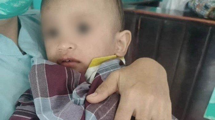Kondisi Balita Peluk Jenazah Ibunya Selama 3 Hari di Kamar Kos