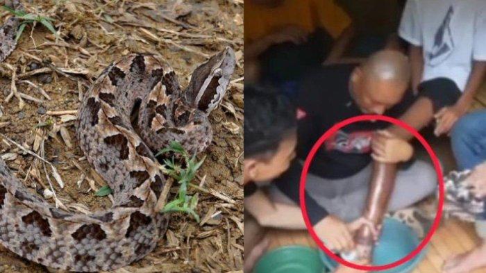 Foto yang menampilkan salah satu kaki seorang bocah tampak gosong disebut karena digigit ular tanah