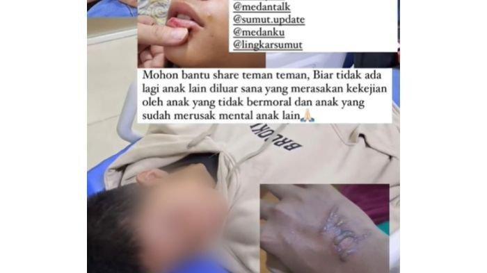 Kasus bullying menimpa salah satu siswa MAN 1 Medan, yang kabarnya beredar viral di media sosial.