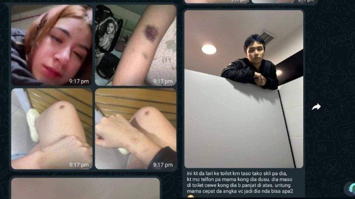 Leon Dozan diduga anaiaya pacarnya.