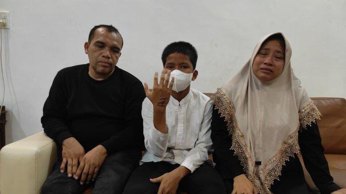 Muhammad Habib (tengah) bernama kedua tuanya Rahmat (kiri) dan ibunya Khairani (kanan) saat menunjukkan luka bakar akibat disundut besi panas yang diduga dilakukan alumni MAN 1 Medan bernama Fauzie Alrasyid Siregar.