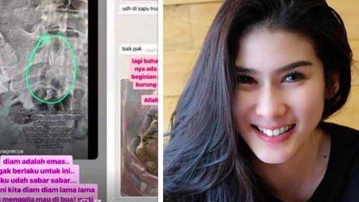 Curhat Stevie Agnecya sebelum meninggal.