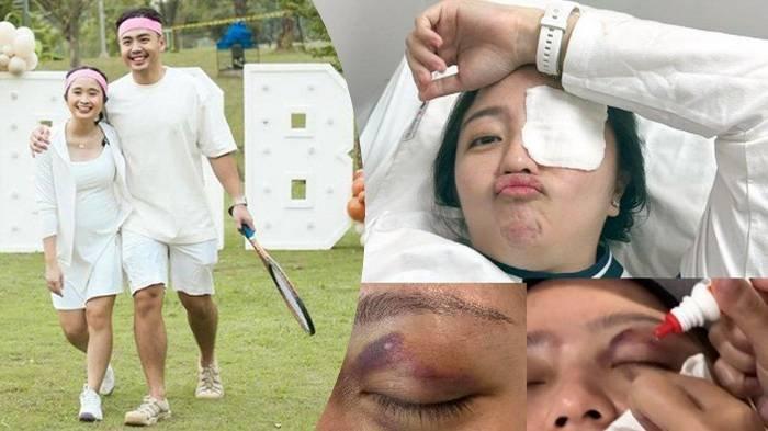 Acara gender reveal Gritte Agatha dan Arif Hidayat memakan korban.