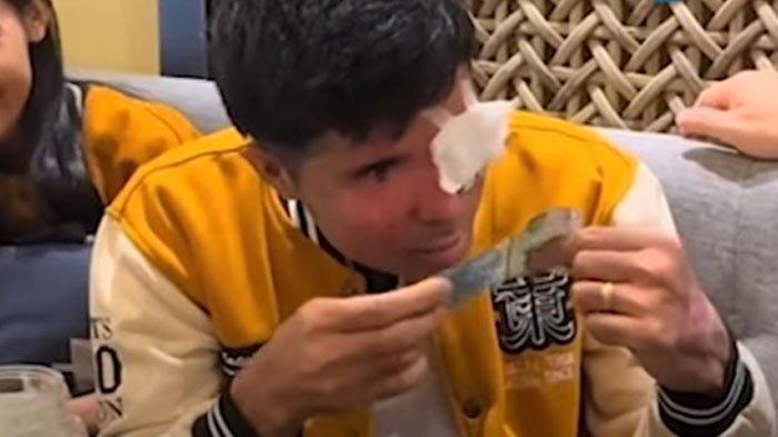 Agus Salim, korban penyiraman air keras yang tengah bersiteru dengan YouTuber Pratiwi Noviyanthi, kini dikabarkan bisa kembali melihat usai divonis buta.