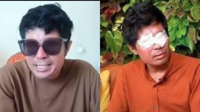 Korban penyiraman air keras Agus Salim masih belum menjalani operasi dan tak dapat uang donasi.