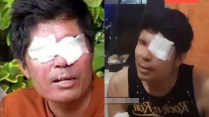Donatur niat bantu pengobatan Agus Salim berujung dilaporkan ke polisi. Agus Salim malah tertawa asyik live TikTok.