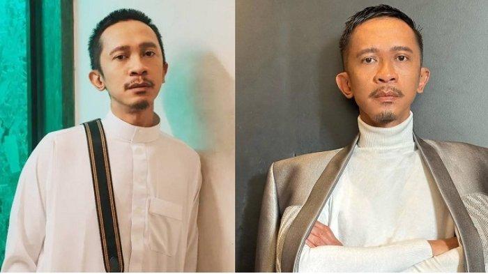 Perubahan penampilan Aming jadi sorotan.