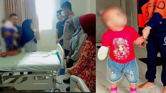 DUGAAN MALPRAKTIK - Arumi balita di Bima dengan tangan kanan diamputasi imbas dugaan malpraktik petugas medis. Sang ibu, Marliana tengah memperjuangkan keadilan dan meminta hukum atas kasus ini ditegakkan.