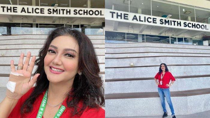 Bella Saphira mendadak unggah foto tangan diperban