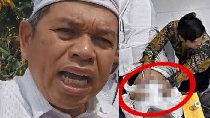 DOKTER LECEHKAN PASIEN - (foto kanan) Tangkapan kayar CCTV dokter kandungan di Garut lecehkan ibu hamil saat USG. Gubernur Jawa Barat, Dedi Mulyadi (foto kiri) minta cabut gelar dan izin praktiknya.