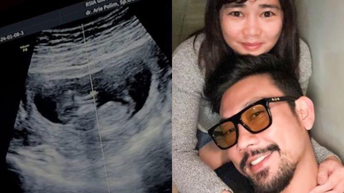 Denny Sumargo umumkan istrinya hamil anak pertama. Akhirnya Olivia Allan berhasil melewati trimester pertama.