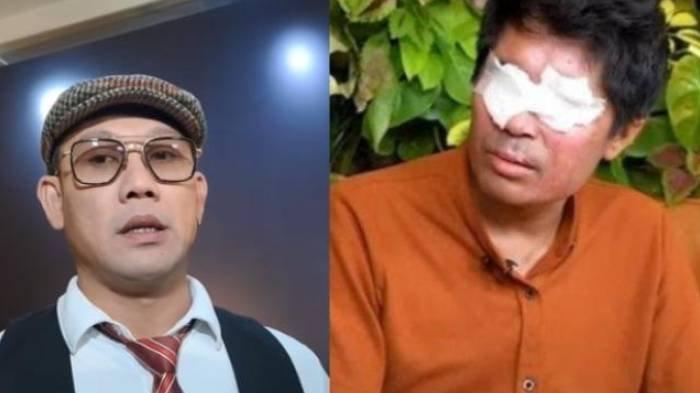 Denny Sumargo umumkan undur dari kasus Agus Salim korban penyiraman air keras.