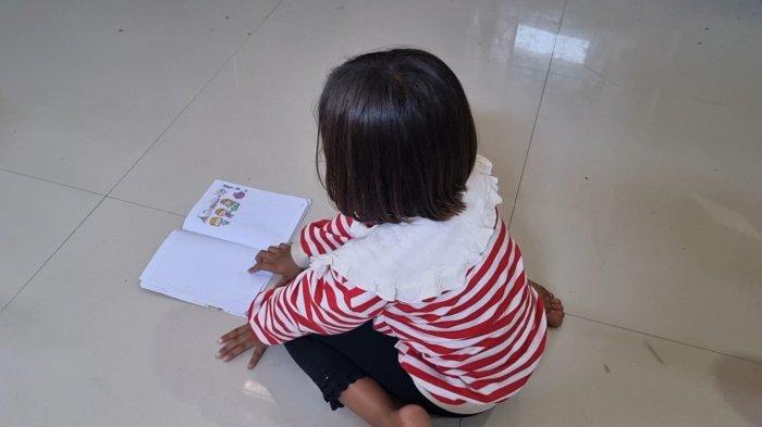 Kondisi SA, siswi SD di Menganti yang dicolok matanya pakai tusuk pentol, Sabtu (16/9/2023).