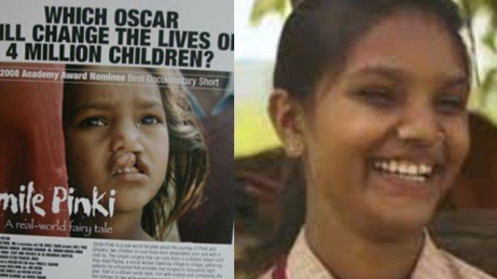 Kondisi hidup mantan artis cilik yang dulunya menang Piala Oscar tetapi malah memprihatinkan hidupnya.