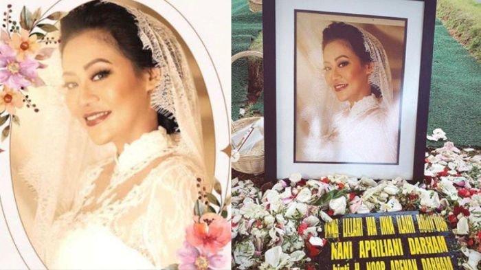 Nanie Darham meninggal dunia usai melakukan prosedur operasi sedot lemak. Artis cantik ini diduga korban malapraktik.